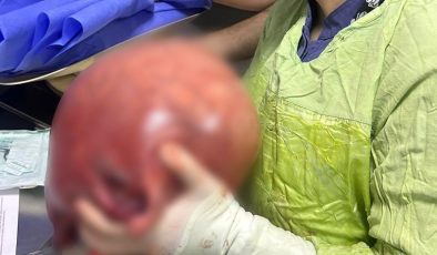 Trabzon’da karın ağrısı şikayetiyle gitti, 5.5 kg kitle çıktı